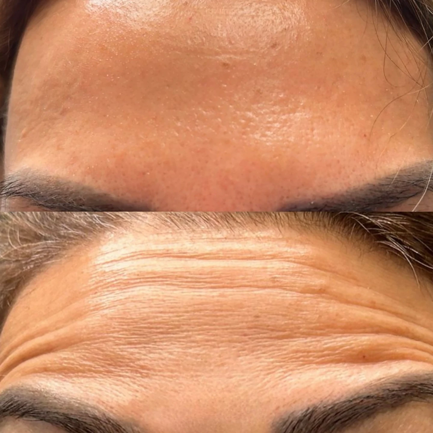 Before-After-Aesthetic-Med-Spa-Fresno-by-Skin-Sculpt-Aesthetics10