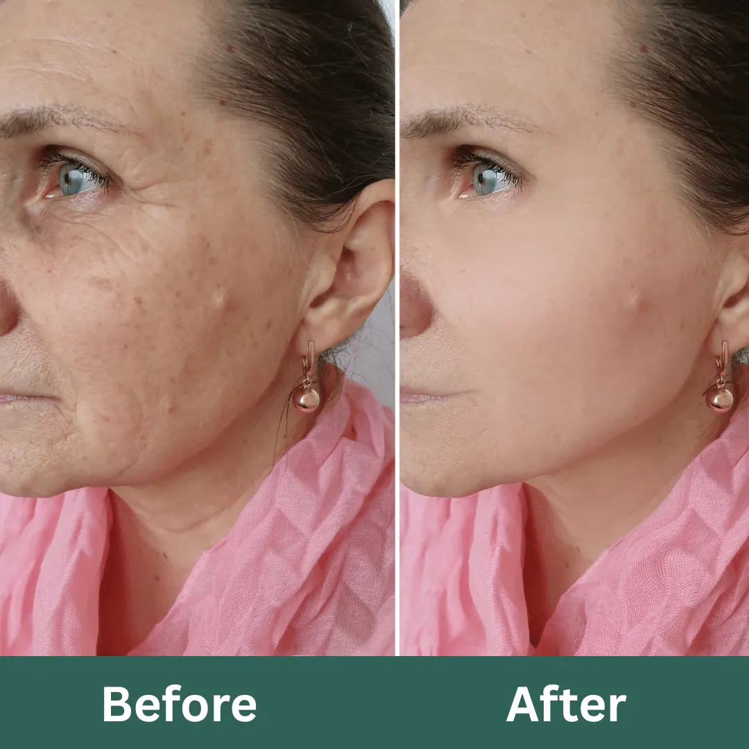 Before-After-Images-Real-Client-Transformations-Skinsculpt-Aesthetics-Fresno-CA19