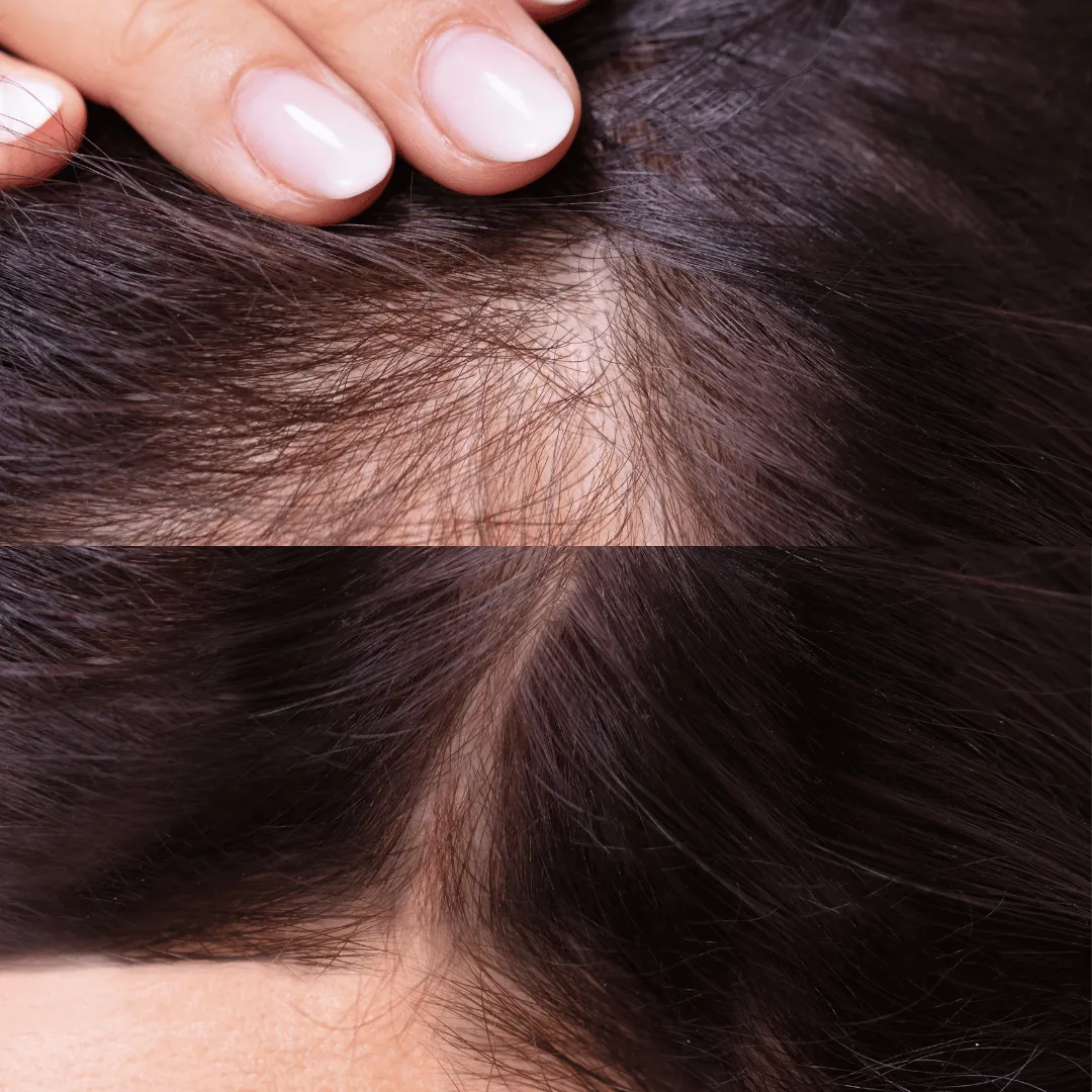 Before-After-Images-Real-Client-Transformations-Skinsculpt-Aesthetics-Fresno-CA22