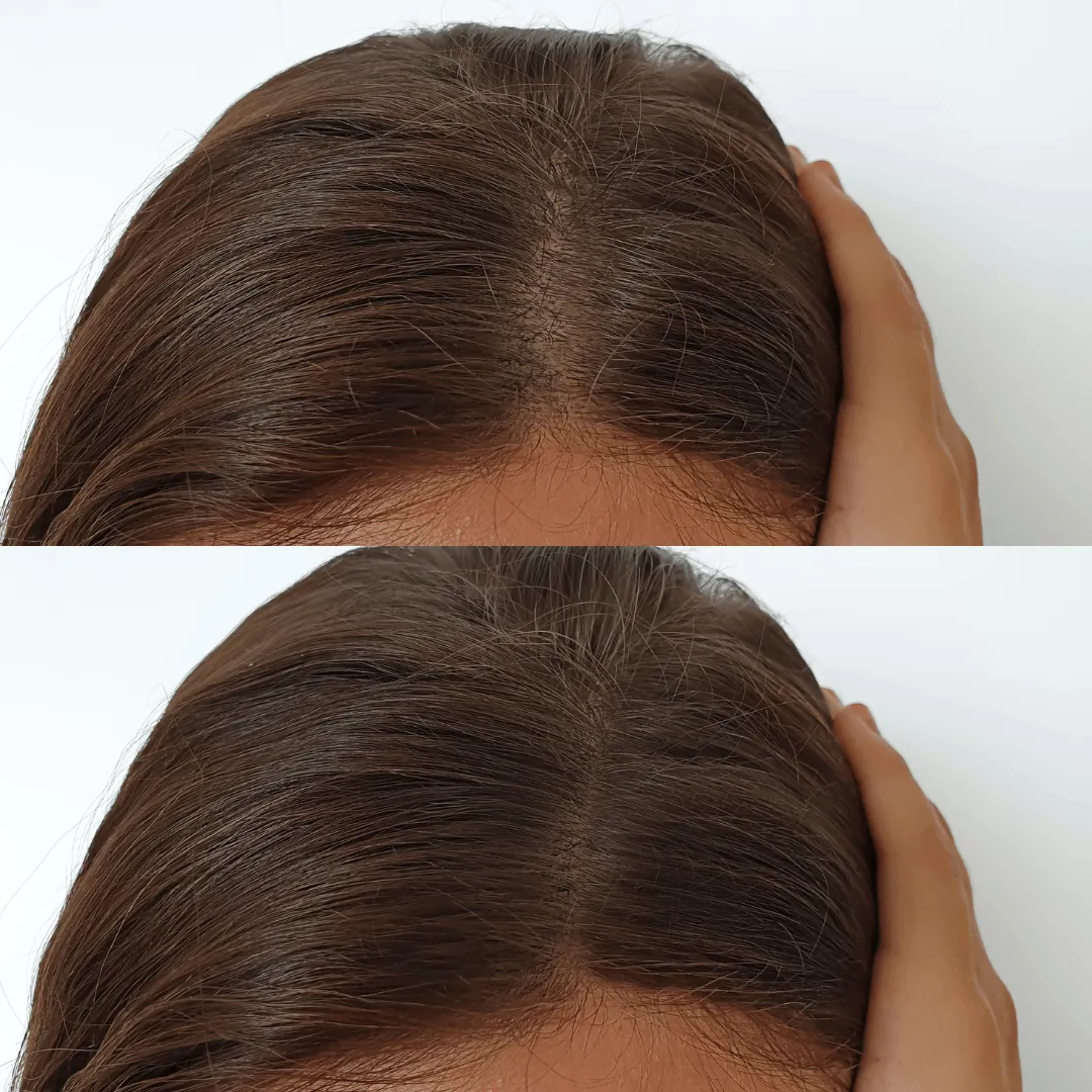 Before-After-Images-Real-Client-Transformations-Skinsculpt-Aesthetics-Fresno-CA23