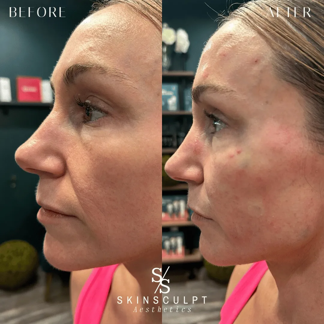Before-After-Images-Real-Client-Transformations-Skinsculpt-Aesthetics-Fresno-CA8