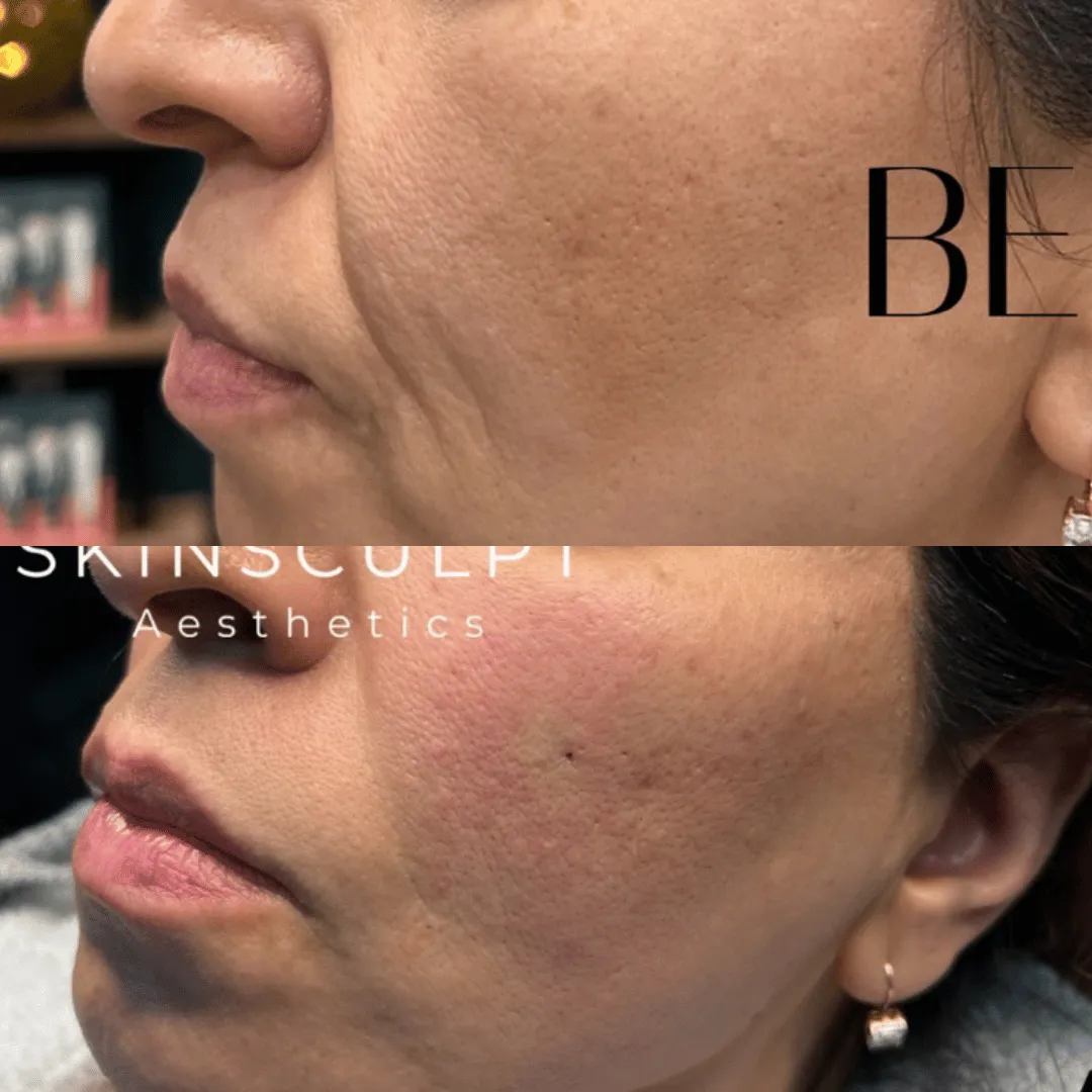 Before-After-Images-Real-Client-Transformations-Skinsculpt-Aesthetics-Fresno-CA9